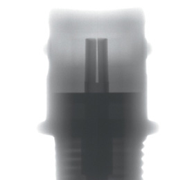 インサート成形品の検査に最適なX線検査装置