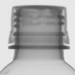 ボトルとキャップの嵌合状態X線画像｜X線非破壊検査装置導入事例｜松定プレシジョン