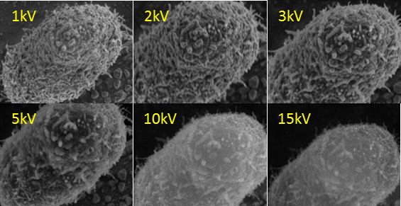 図. 照射電圧1kV～15kVの条件でのカーボンナノチューブのSEM画像