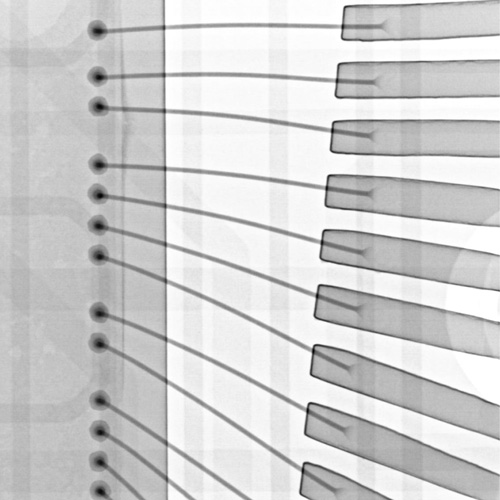 ワイヤーボンディングのX線透過画像