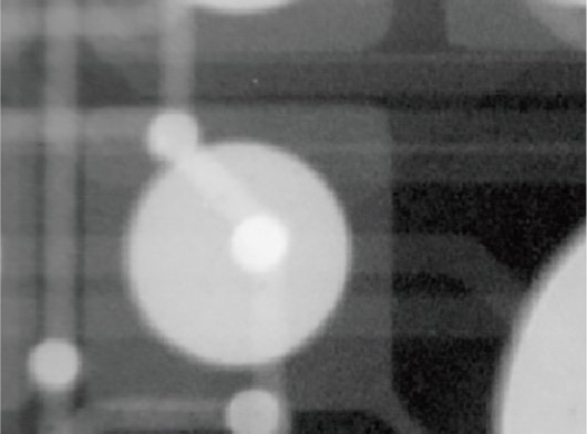 フィルタ処理（諧調反転）を適用したX線透過画像