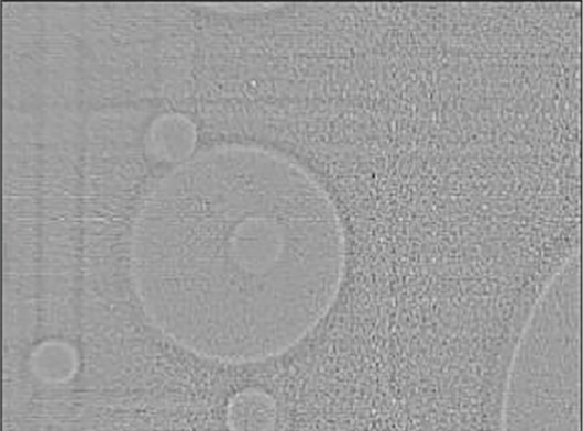 フィルタ処理（ラブラシアン）を適用したX線透過画像