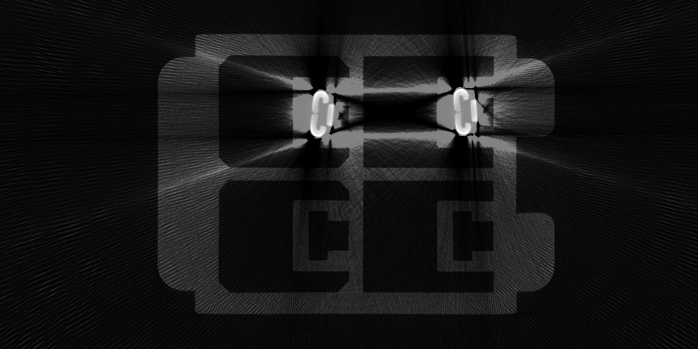 メタルアーチファクトが発生したICのX線透過画像