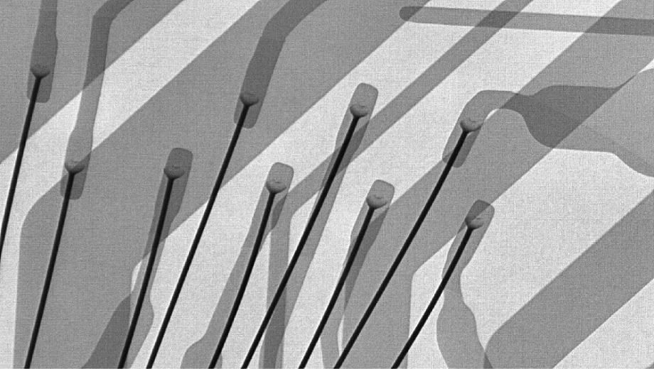 ワイヤーボンディングを拡大撮影したX線透過画像