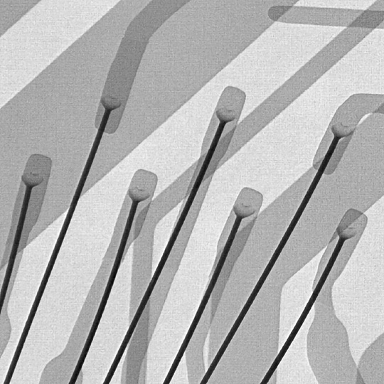 ワイヤーボンディングを拡大したX線透過画像